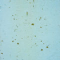 rough blue painted metal background free texture